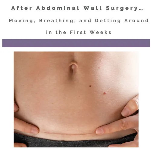 After Abdominal Wall Surgery… Moving, Breathing, and Getting Around in the First Weeks